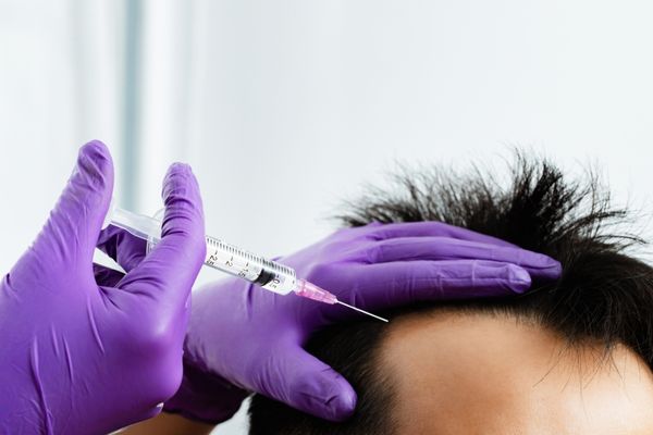 Hair Transplant Tips